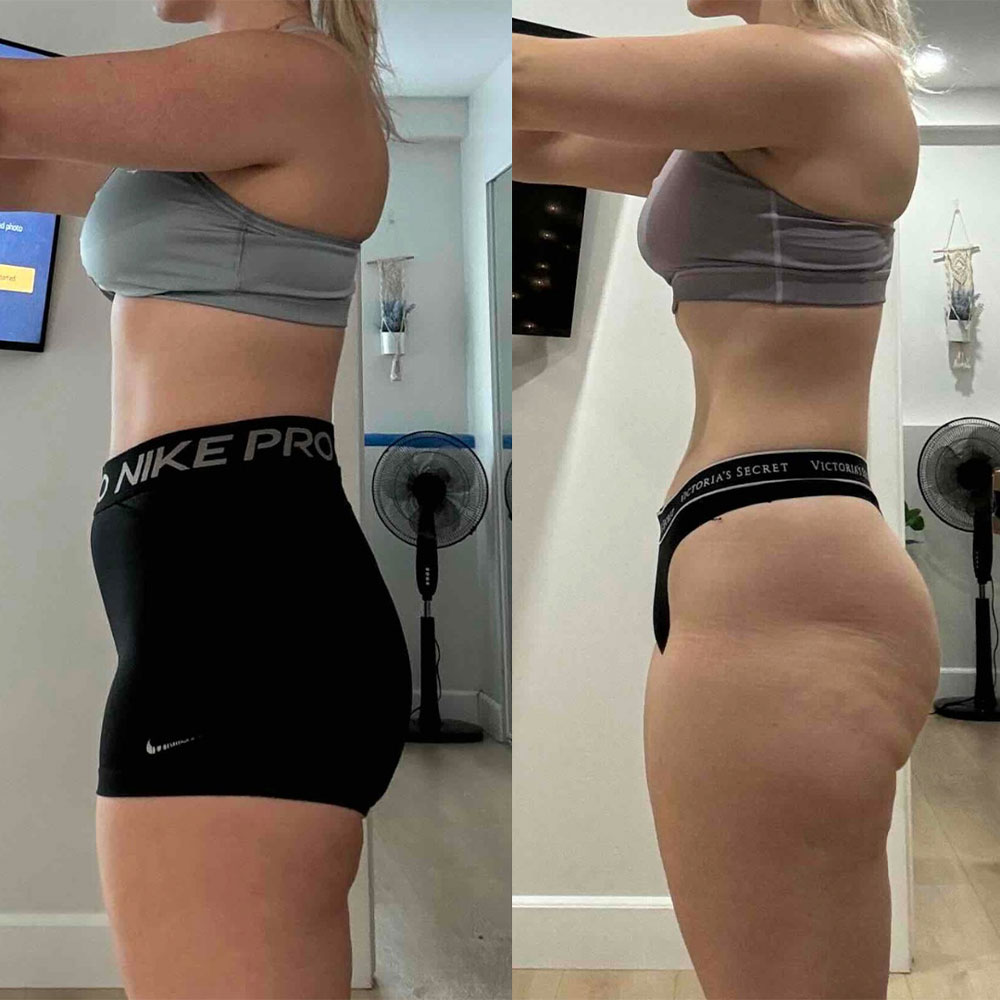 Transformation 2